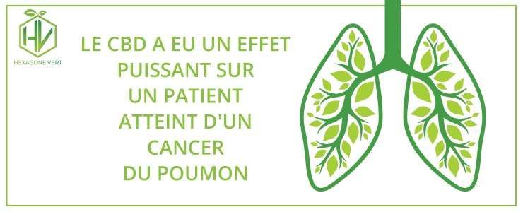 Le CBD a eu un effet puissant sur un patient atteint d'un cancer du poumon