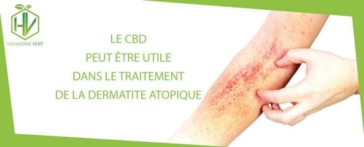 CBD dermatite atopique