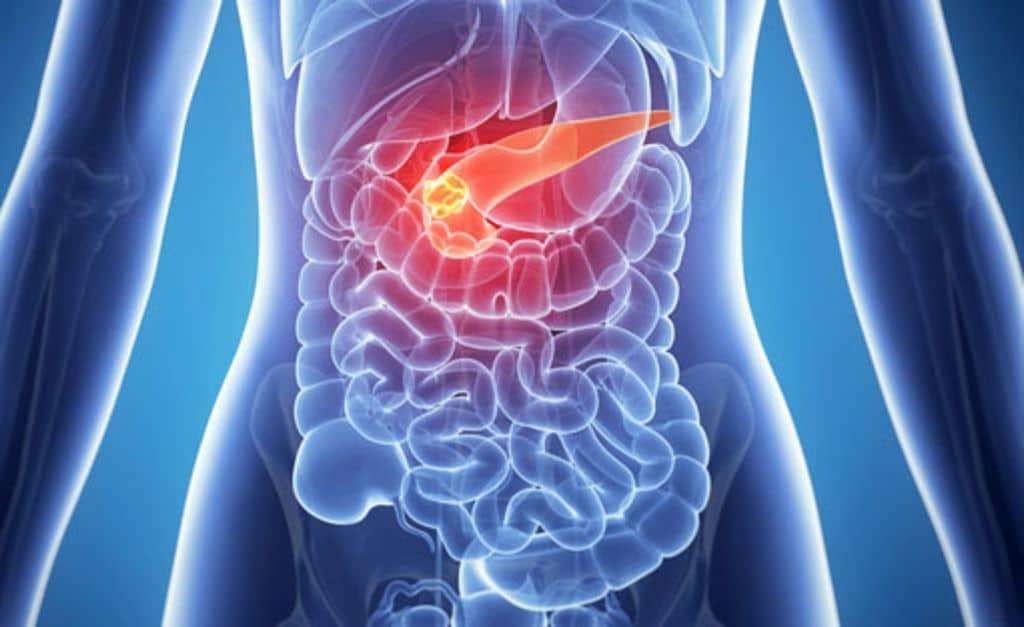 Le CBD augmente les effets anticancéreux de la gemcitabine contre le cancer du pancréas