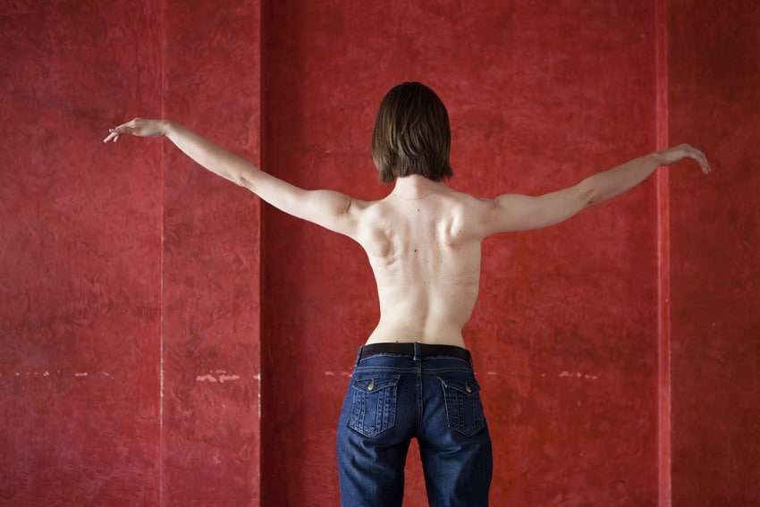 Le CBD et le CBDV peuvent être utile dans la dystrophie musculaire
