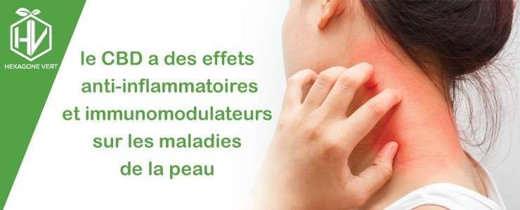 Le CBD a des effets anti-inflammatoires sur les maladies de peau